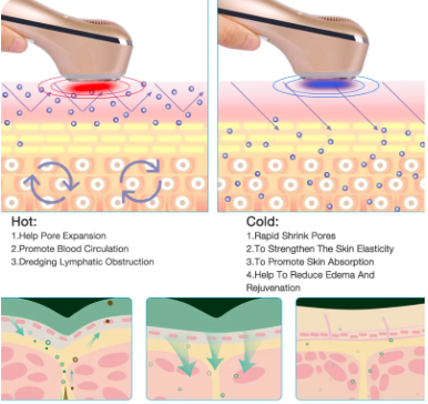 Miniatura 3 de REJUVENECIMIENTO FOTONICO